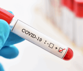 Új halálos vírus terjed, itt a következő Covid? Megszólaltak a legjobb virológusok, ez vár Magyarországra – a Nipah ellen nincs oltás